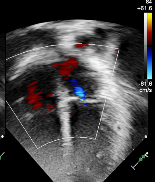 echo-scan